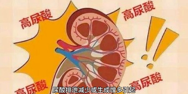 突然痛風？別再只怪啤酒和燒烤！真正的“尿酸元兇”遠比你想的多！